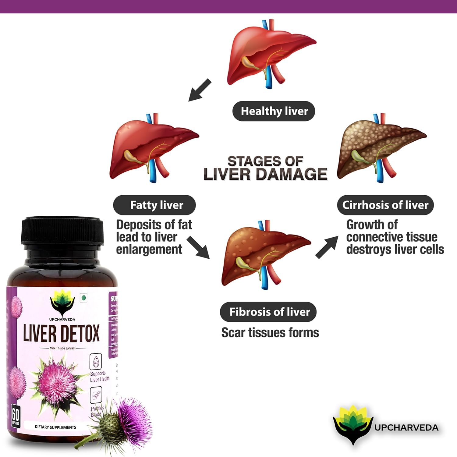 Liver Detox Supplement – Milk Thistle Extract | Supports Liver Health & Detox | Purifies Blood | 60 Vegetarian Capsules | Dietary Supplement - Image 8
